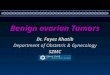Benign ovarian Tumors Dr. Fayez Khatib Department of Obstetric & Gynecology SZMC