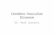Cerebro-Vascular Disease Dr. Raid Jastania. Cerebrovascular disease – Congenital/Developmental – Acquired – Localized lesion: Blockage – Thrombosis