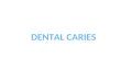 DENTAL CARIES. Chronic, painless slowly progressive and destruction of the enamel and dentin by the acid produced by plaques bacterial that ferments carbohydrates
