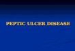PEPTIC ULCER DISEASE. PATHOGENY Low PGE2 secretion Low PGE2 secretion Low secretion of mucus and bicarbonate Low secretion of mucus and bicarbonate Decreased