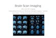 Brain Scan Imaging MRI, CAT, PET Imaging Interpreting Functions of the Brain through Imaging – Activity Case Study – Professional Sports and Head Trauma