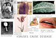 Polio Smallpox Mumps Potyvirus infection Tobacco mosaic virus infection Bacteriophage VIRUSES CAUSE DISEASE Herpes simplex type 2 infection