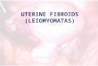 UTERINE FIBROIDS (LEIOMYOMATAS). Smooth Muscle Tumor of the Uterus The most common uterine tumor –Occurring in about 30% of women above the age of 30