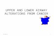 UPPER AND LOWER AIRWAY ALTERATIONS FROM CANCER 18/6/2015