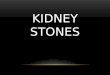 KIDNEY STONES. WHAT ARE KIDNEY STONES? Kidney Stones are crystal deposits of varying size that form in the kidneys
