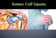 Anatomy of shoulder joint Anatomy & Physiology of rotator cuff Types of rotator cuff injuries Signs and Symptoms Diagnosed by Treatments Rehabilitation