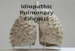 Idiopathic Pulmonary Fibrosis. What is Idiopathic Pulmonary Fibrosis? Idiopathic Pulmonary Fibrosis (IPF) is a disease in which inflammation of Lung parenchyma