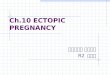 Ch.10 ECTOPIC PREGNANCY 부산백병원 산부인과 R2 서영진. Implantation anywhere (normally, endometrial lining of the uterine cavity) 2% in U.S.A >95% : involve oviduct