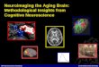 NIA Neuroeconomics Workshop Scott Huettel, Duke University Neuroimaging the Aging Brain: Methodological Insights from Cognitive Neuroscience