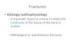 Fractures Etiology/pathophysiology – A traumatic injury to a bone in which the continuity of the tissue of the bone is broken – Pathological or spontaneous