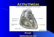 Arrhythmias Mustafa Salehmohamed, D.O.. DEFINITIONS  An arrhythmia is defined as any rhythm other than normal sinus rhythm  Arrhythmias can be categorized