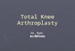 Total Knee Arthroplasty 06/06/2006 Dr. Rami Eid. Introduction ► TKA is one of the most successful and commonly performed orthopedic surgery. ► The best