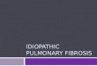 IDIOPATHIC PULMONARY FIBROSIS. TREATMENT IN IPF Treatments tried in IPF Antifibrotic Activity Anti-inflammatory Interferon-  1b Pirfenidone Endothelin