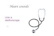 Heart sounds Use a stethoscope First heart sound Lub Closing of the AV valves Longer Louder