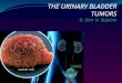 THE URINARY BLADDER TUMORS D. Diar H. Bajalan. 95 % of primary bladder tumours originate in the epithelium; The remainder arise from connective tissue