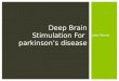 Jake Morris Deep Brain Stimulation For parkinson’s disease