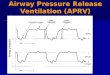 Airway Pressure Release Ventilation (APRV) Objectives Provide the definition and names for APRV Provide the definition and names for APRV Explain the