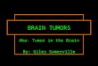 Aka: Tumor in the Brain By: Giles Somerville B RAIN T UMORS