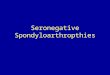 Seronegative Spondyloarthropthies. Definition -Spondyloarthropathies (SA) are cluster of interrelated and overlapping chronic inflammatory rheumatic disease