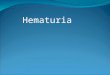 Hematuria. HAEMATURIA Common finding Incidental DEFINING HAEMATURIA Visible haematuria Non visible haematuria (dipstick and microscopic)