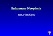 Pulmonary Neoplasia Prof. Frank Carey. Lung Neoplasms r Primary l benign (rare) l malignant (very common) r Metastatic (Very common)