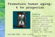Premature human aging: t he progerias A&S300-002 Jim Lund Reading: Genetic alterations in accelerated ageing syndromes Do they play a role in natural ageing?