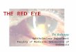 THE RED EYE Tri Rahayu Ophthalmology Department Faculty of Medicine, University of Indonesia