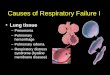 Causes of Respiratory Failure I Lung tissue –Pneumonia –Pulmonary hemorrhage –Pulmonary edema –Respiratory distress syndrome (hyaline membrane disease)