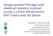 Image-guided therapy and medical robotics tutorial using a LEGO Mindstorms NXT robot and 3D Slicer Danielle F. Pace, B.CmpH Ron Kikinis, M.D. Nobuhiko