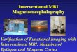 Interventional MRI Magnetoencephalography Verification of Functional Imaging with Interventional MRI: Mapping of Epilepsy and Eloquent Cortex