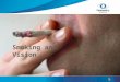 Smoking and Vision. Smoking and vision Facts about smoking What is in a cigarette? Cataracts Glaucoma Macular degeneration Strabismus Contact lenses Environmental