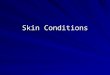 Skin Conditions. Functions of Skin Protection: –UV –Infection –Heat Regulation –Injury –Fluid/Electrolytes Loss Due to tight packing of cells in upper