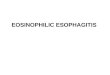 EOSINOPHILIC ESOPHAGITIS. EOSINOPHILIC ESOPHAGITIS DISEASE WITH MANY NAMES Congenital esophageal stenosis Feline esophagus Ringed esophagus Corrugated