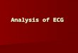 Analysis of ECG. Elecrtocardiogram It is the method of registration of heart bioelectrical potential from the chest of patient It is the method of registration