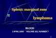 1 Splenic marginal zone lymphoma BLOOD 1 APRIL 2003 VOLUME 101, NUMBER 7