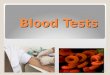 Blood Tests. Hematology The study of blood, its functions, and composition Blood is composed of 4 parts ◦(1) Plasma  Liquid where the other components