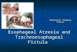 Esophageal Atresia and Tracheoesophageal Fistula Pediatric Surgery Clinic