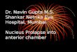 Dr. Navin Gupta M.S. Shankar Netrika Eye Hospital, Mumbai Nucleus Prolapse into anterior chamber