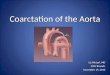 Coarctation of the Aorta Liz Wetzel, MD CICU Rounds November 19, 2010