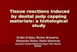Tissue reactions induced by dental pulp capping materials: a histological study Tissue reactions induced by dental pulp capping materials: a histological