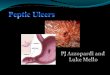 A sore in the lining in the ach or duodenum. Most commonly caused by infection with the bacterium h. pylori What is an ulcer? Sharp abdominal pains, bloating,