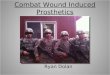 Combat Wound Induced Prosthetics Ryan Dolan. Casualties in Iraq and Afghanistan Over 50,000 soldiers wounded 16,000 of these have been severe, disabling