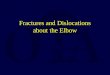 Fractures and Dislocations about the Elbow. C R I T O E 2,4,6,8,10,12