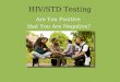 HIV/STD Testing Are You Positive that You Are Negative?