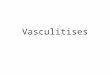 Vasculitises. Outline Basics Small groups Review
