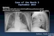 History : 76-year-old male with severe mitral insufficiency, pulmonary arterial hypertension, acute dyspnea Case of the Month 3 September 2015 Authors: