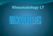 Vasculitides constitute a spectrum of diseases characterized by inflammation & necrosis of blood vessels with resulting ischemia of those tissues