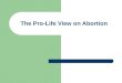 The Pro-Life View on Abortion. Religious Beliefs and Civil Rights