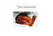 The Neonate. Plan for session Size and Gestation Changes at birth Common Neonatal Problems Neonatal Checks