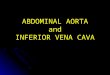 ABDOMINAL AORTA and INFERIOR VENA CAVA. Abdominal Aorta Extends from: Extends from:T12. To: To:L4
